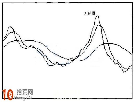 圖解5日均線A形頂形態賣出法 圖解5日均線A形頂形態賣出法,拾荒網