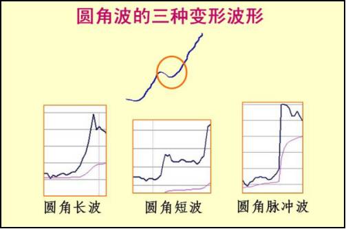 股票盤口分時語言之三大分時走勢類型 1:圓角波(圖解) 股票盤口分時語言之三大分時走勢類型 1:圓角波(圖解),拾荒網